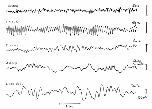 EEG Sketch of EEG signals for different mental states